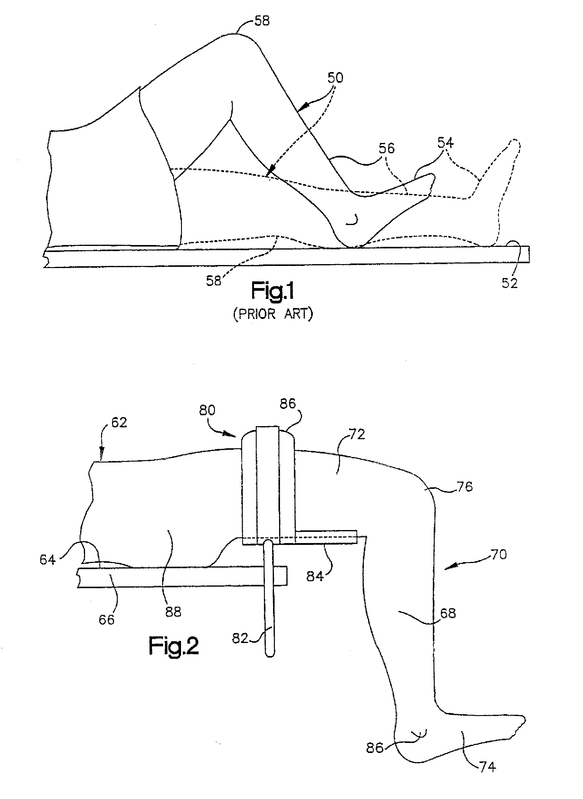 Minimally Invasive Surgical Systems and Methods