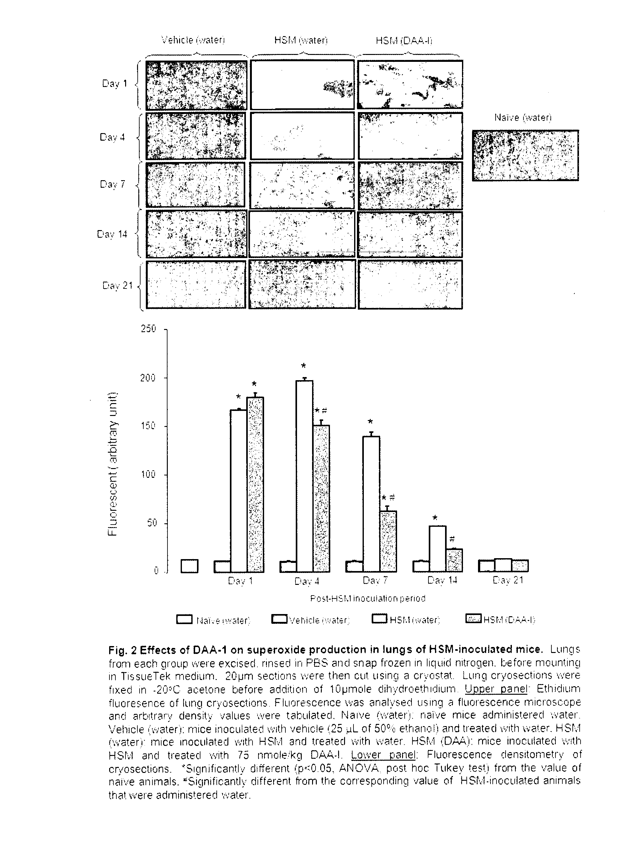 Use of des-aspartate-angiotensin i in inflammation-related pathologies and diseases