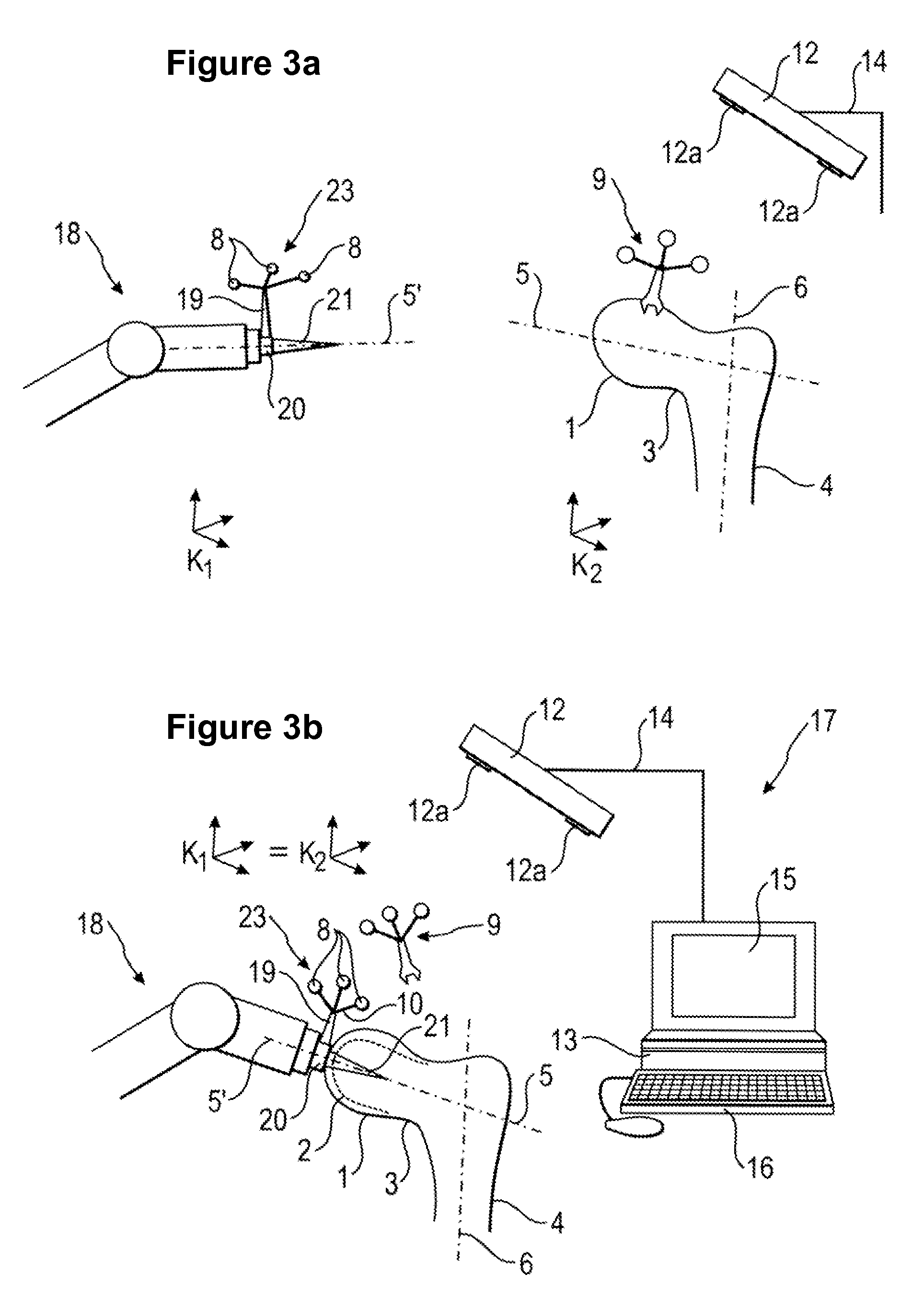 Tool attachment for medical applications