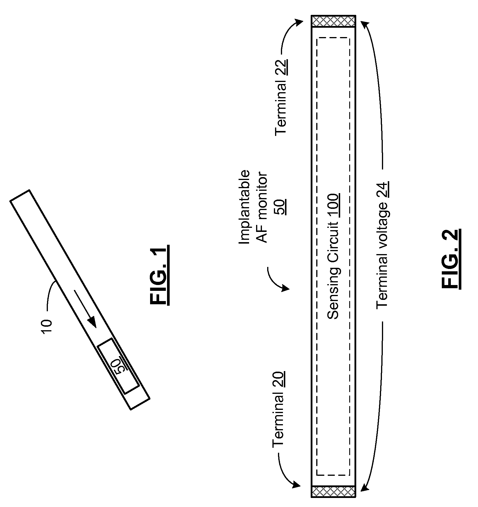 Needle implantable atrial fibrillation monitor and methods for use therewith