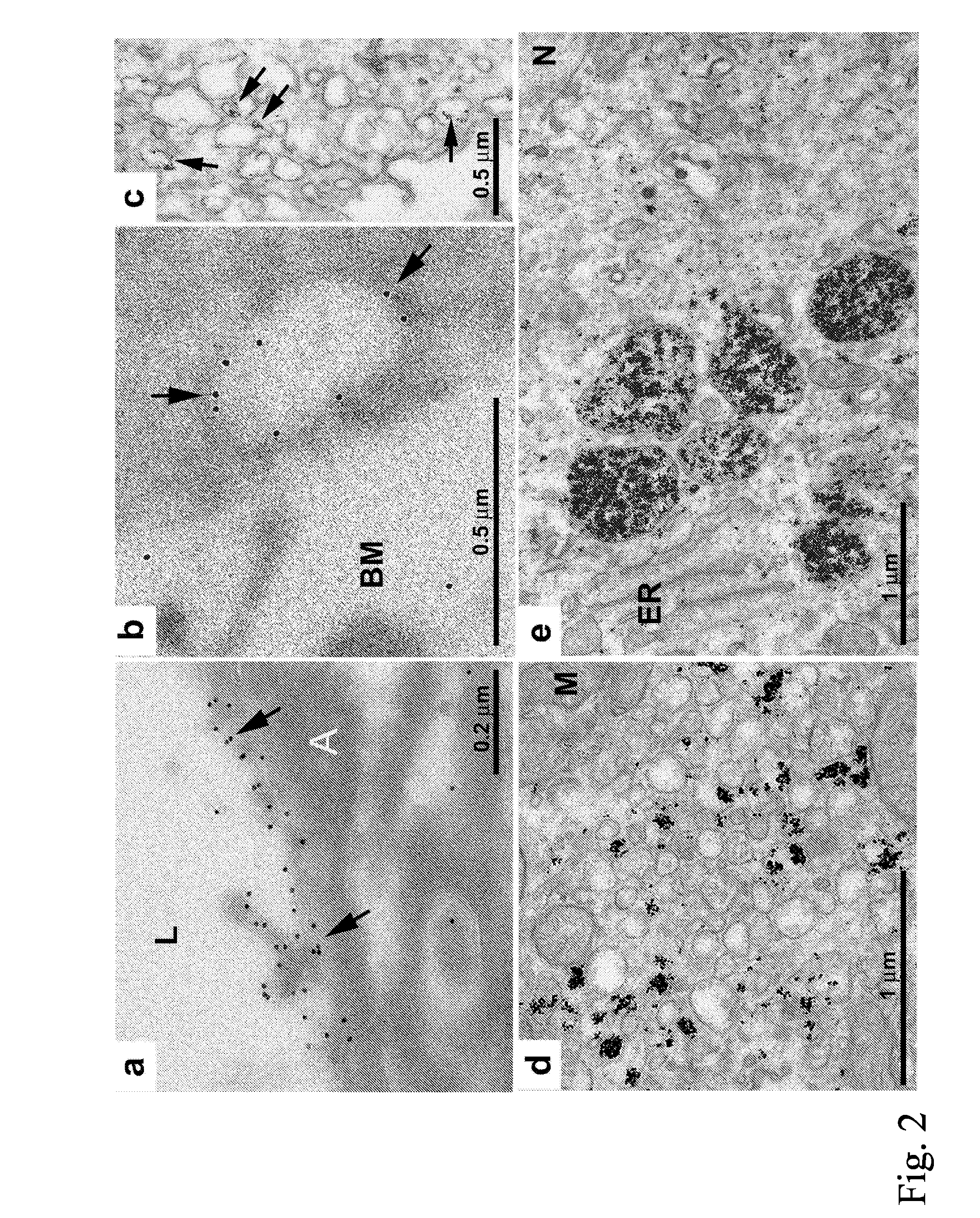 Method For Testing A Compound For A Therapeutic Effect And A Diagnostic Method