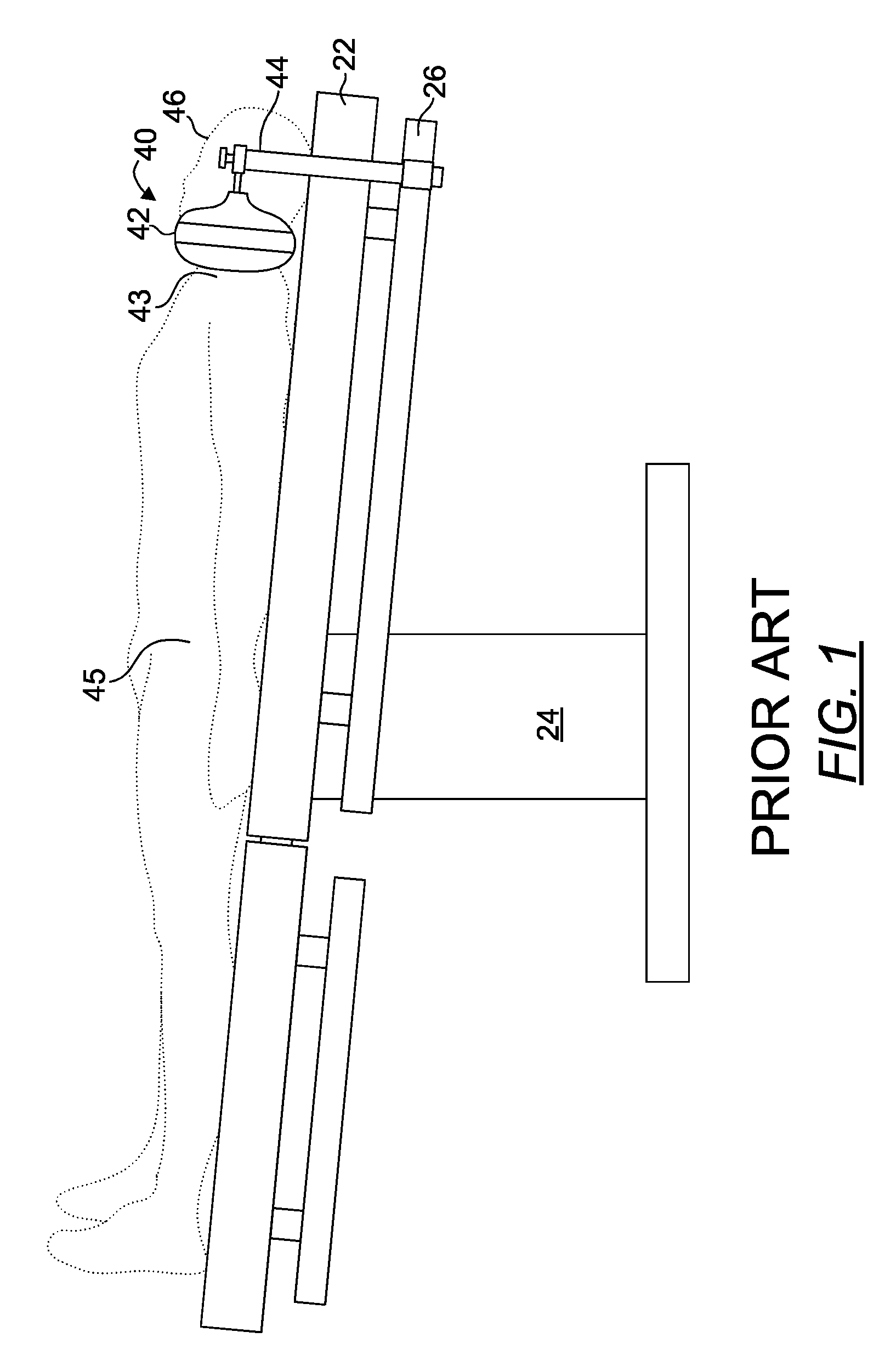 Operating table patient positioner and method