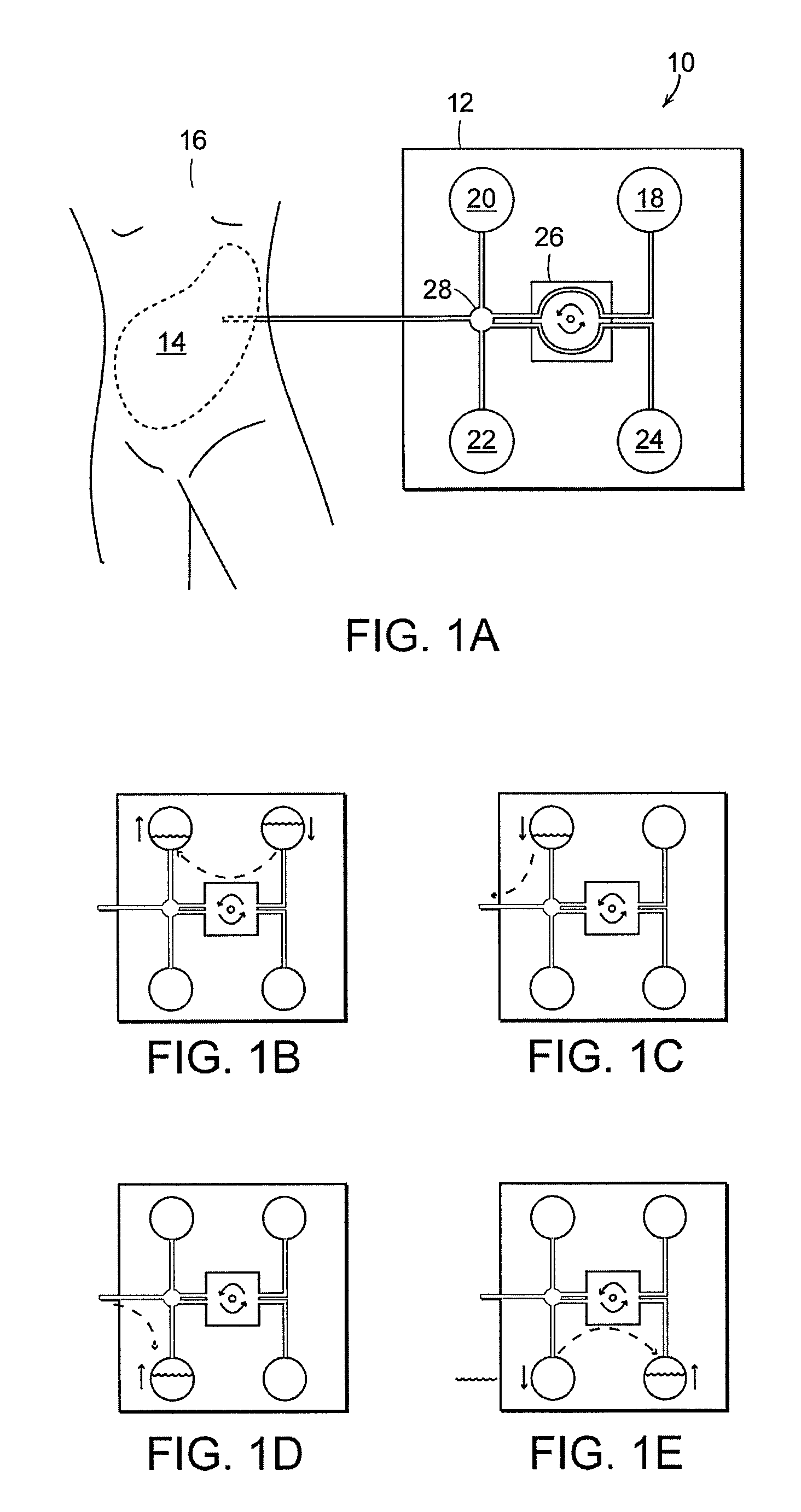 Early stage peritonitis detection apparatus and methods