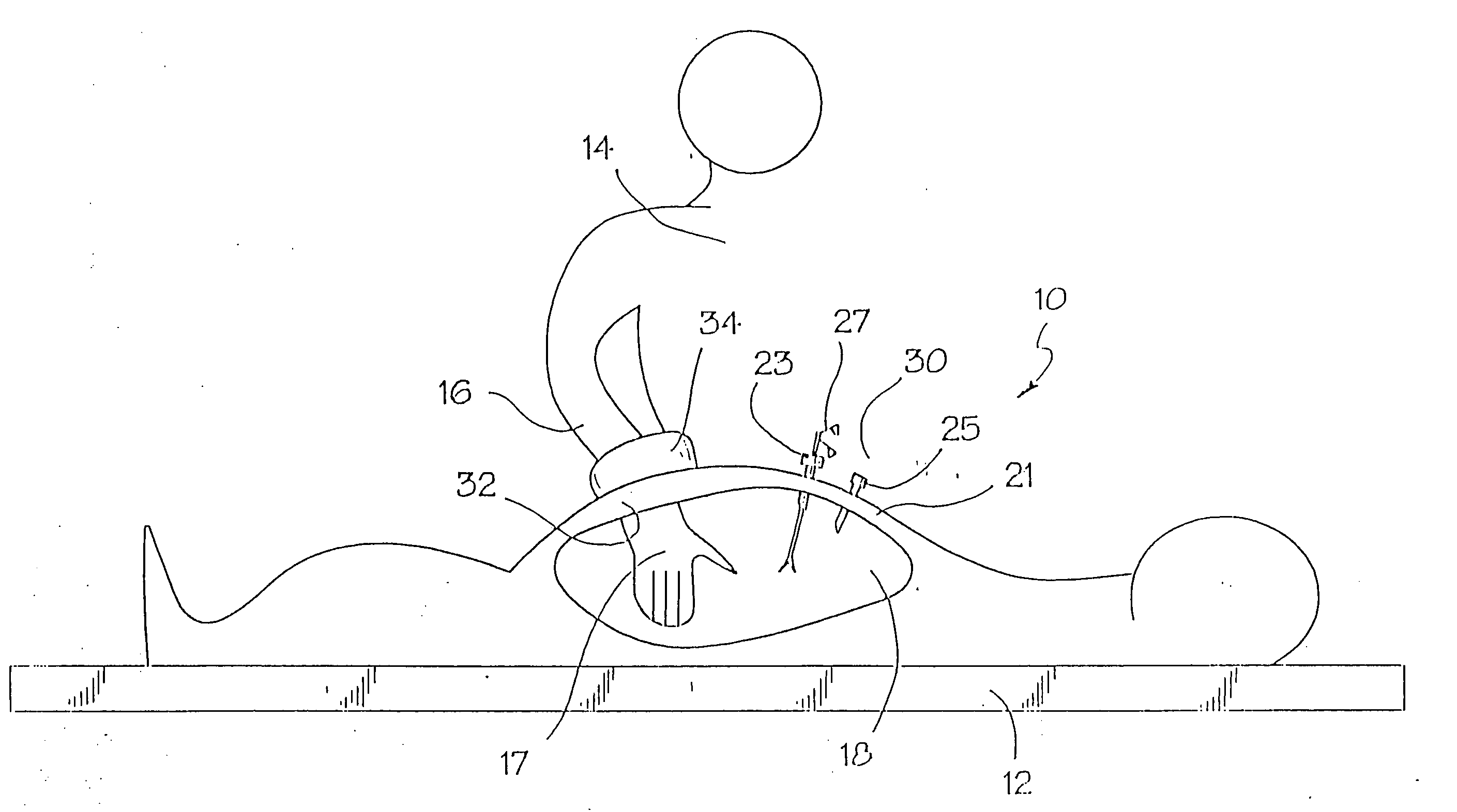Surgical access apparatus and method