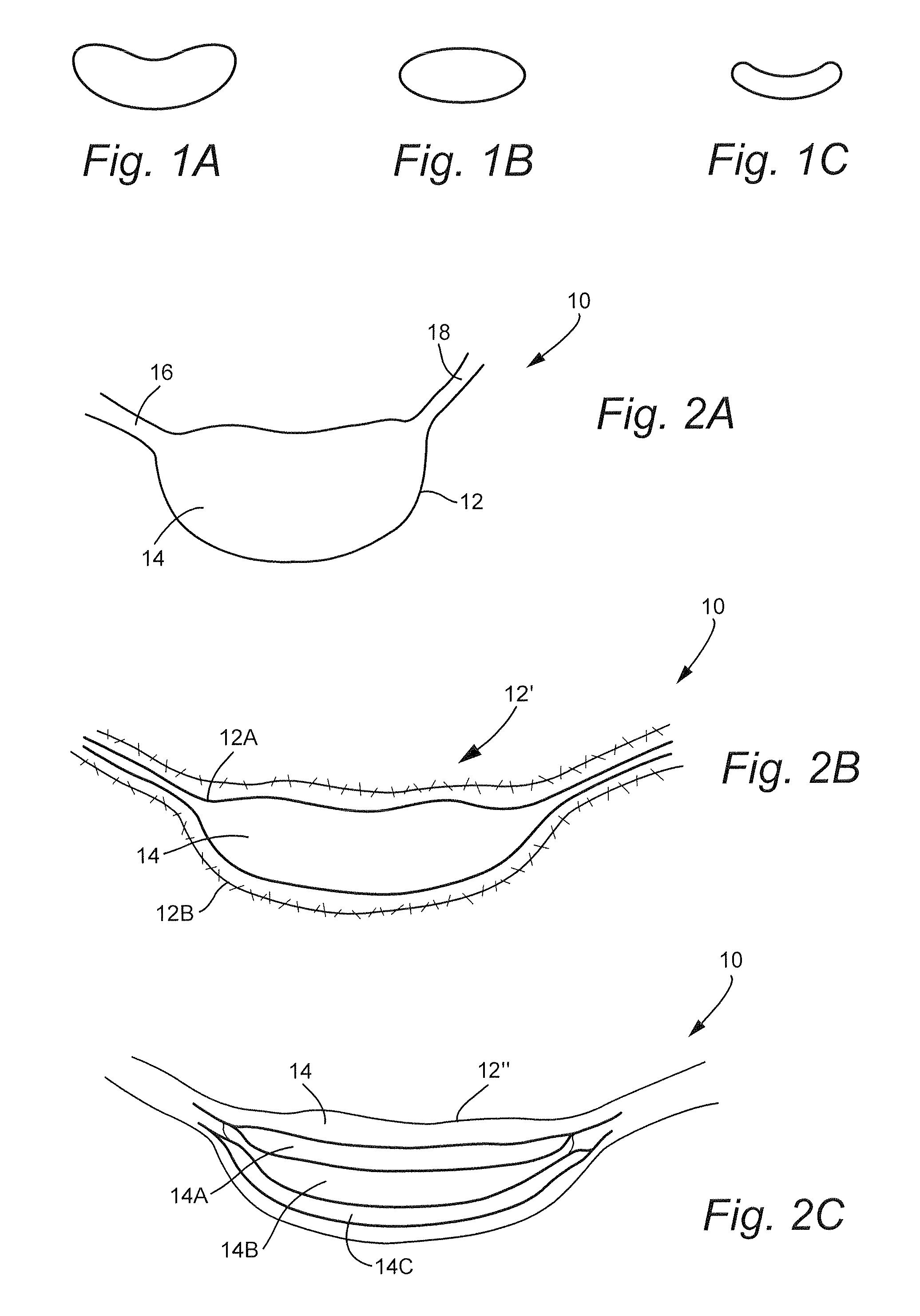 Transpedicular, Extrapedicular and Transcorporeal Approaches to the Intervertebral Discs