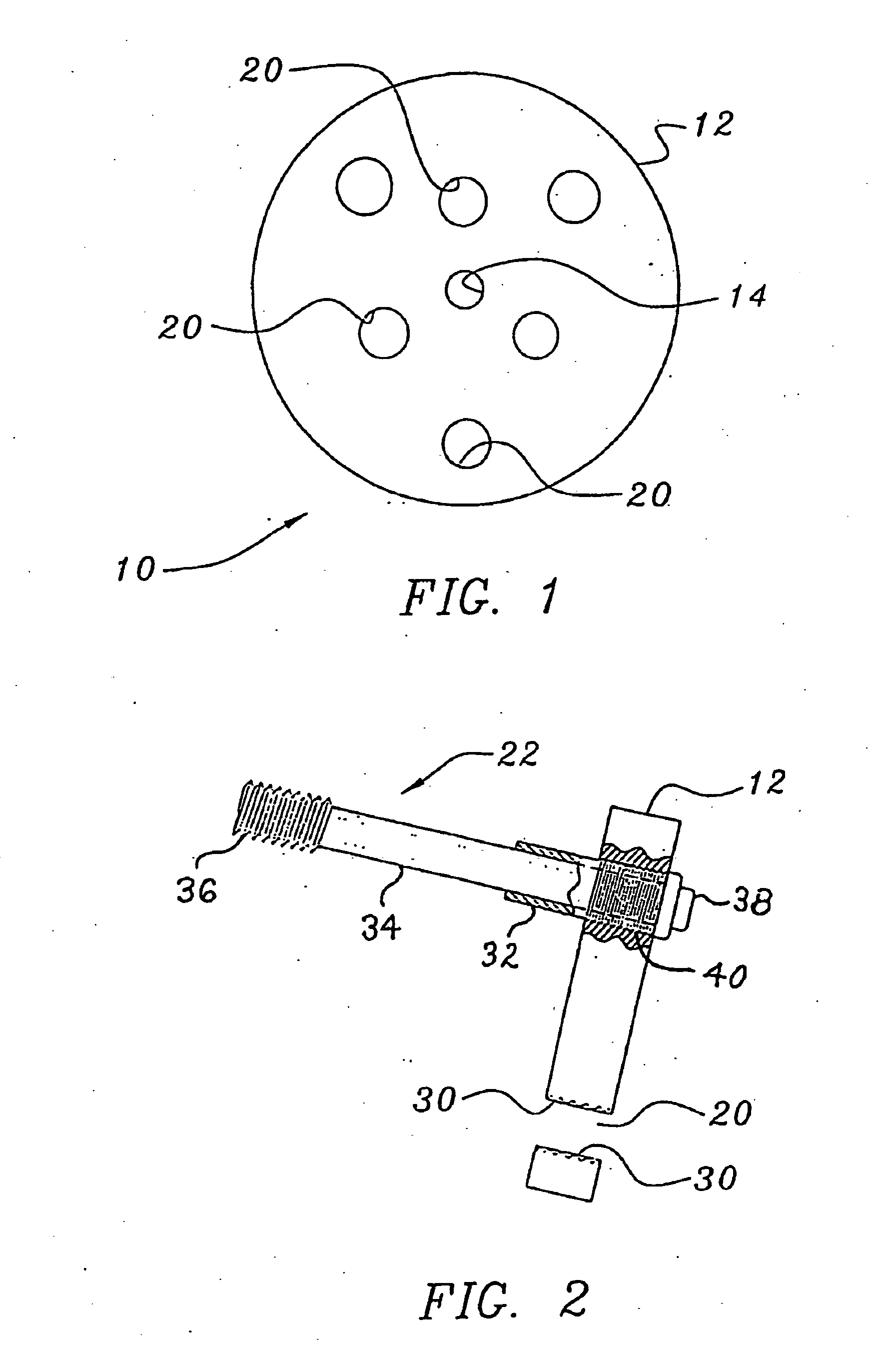 Bone end (epiphysis) fracture fixation device and method of use