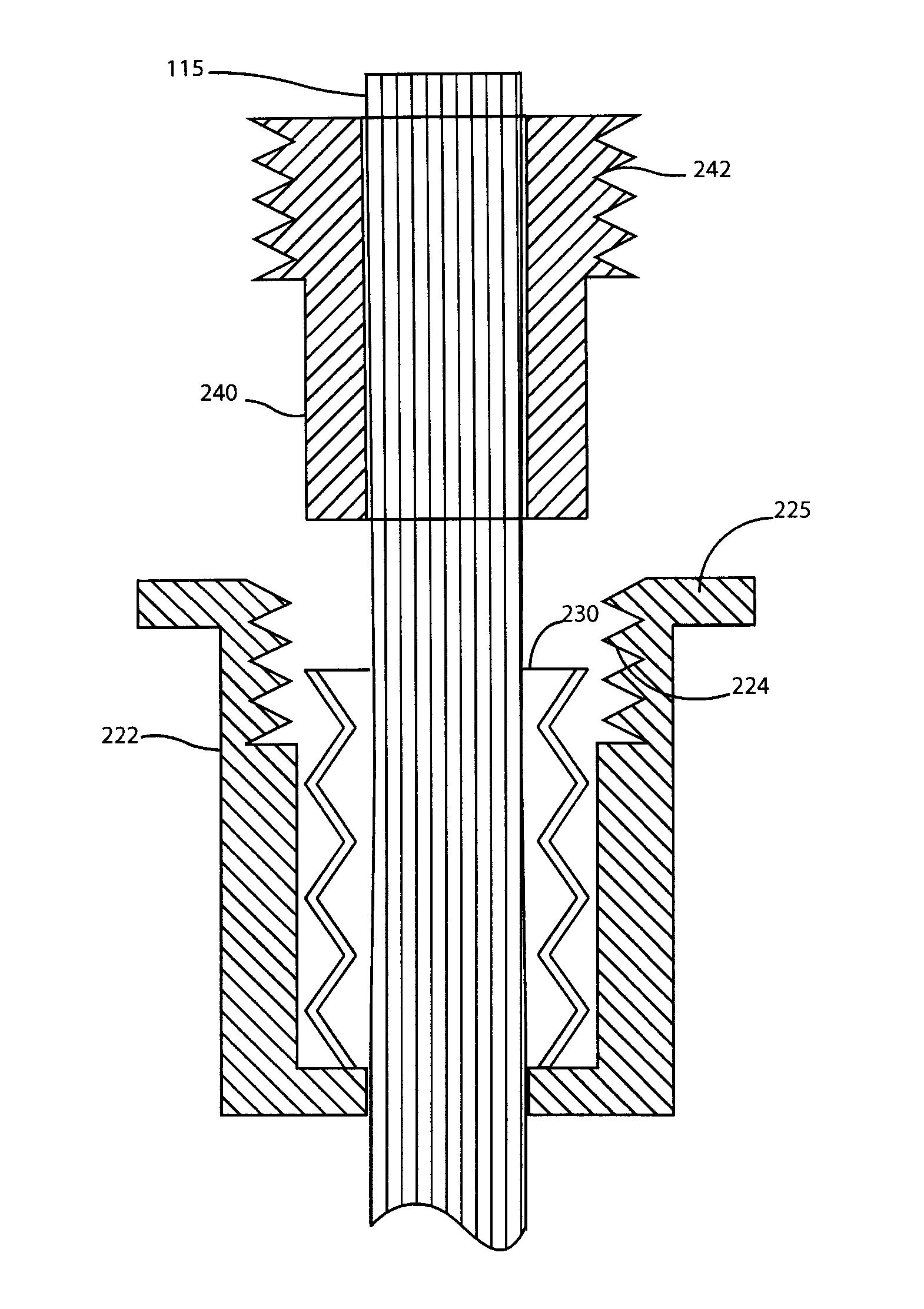 Surgical kits and methods