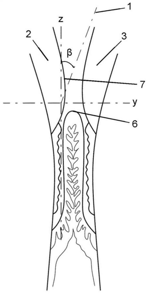 Periodontal pocket for directing flow of irrigation fluid in mouth of subject