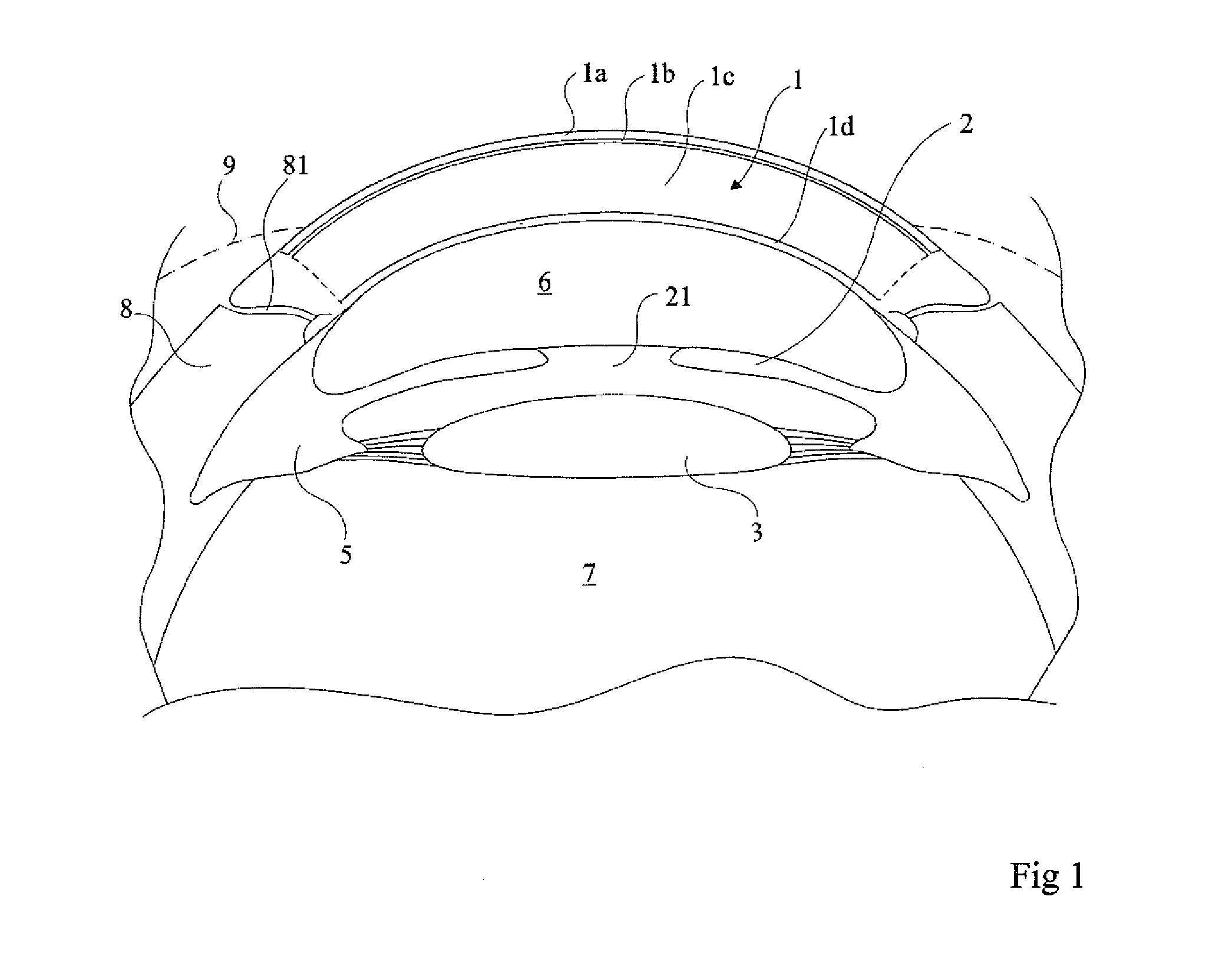 System for Measuring Intraocular Pressure