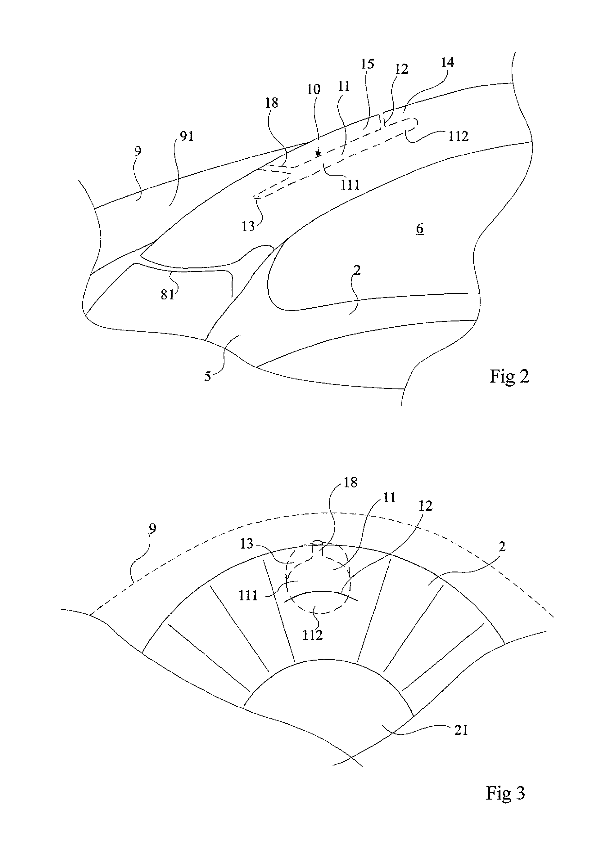 System for Measuring Intraocular Pressure