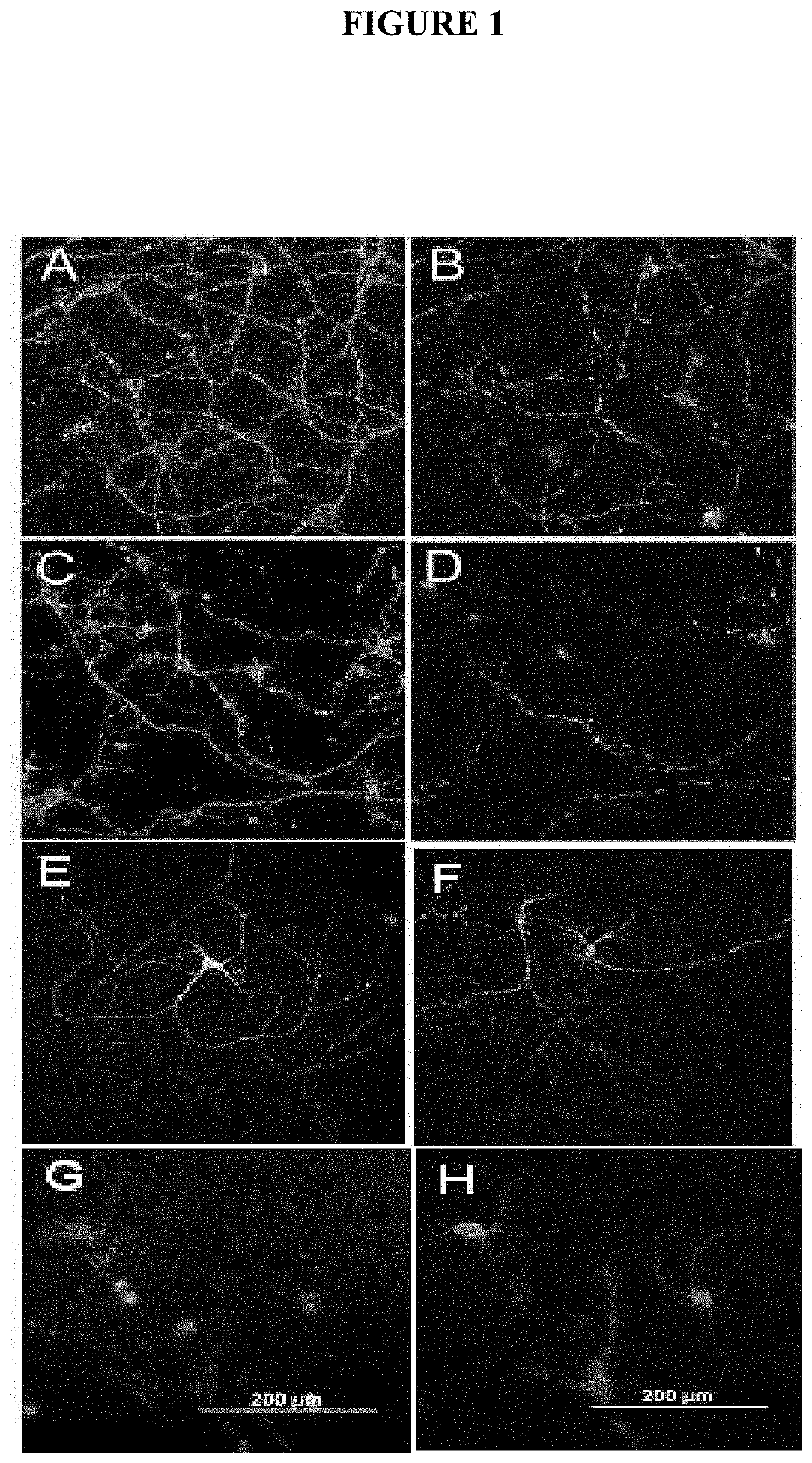 Human antibodies and diagnostic and therapeutic uses thereof for the treatment of neurological disease