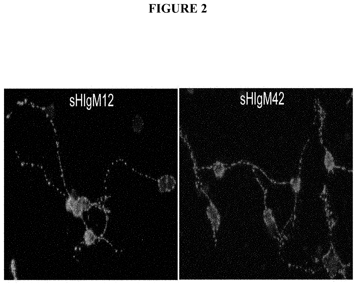 Human antibodies and diagnostic and therapeutic uses thereof for the treatment of neurological disease