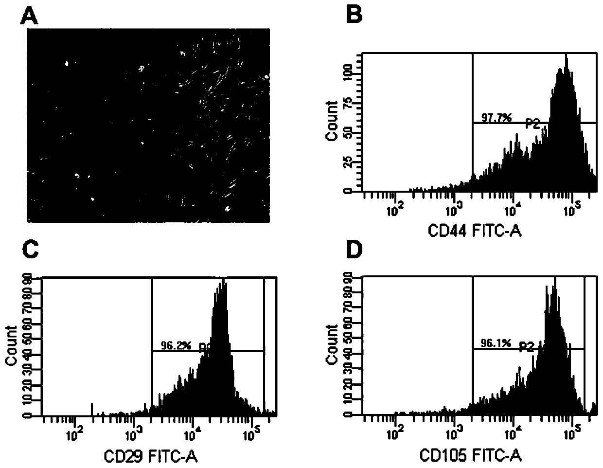 Mesenchymal stem cell composite active factor freeze-dried powder as well as preparation method and application thereof