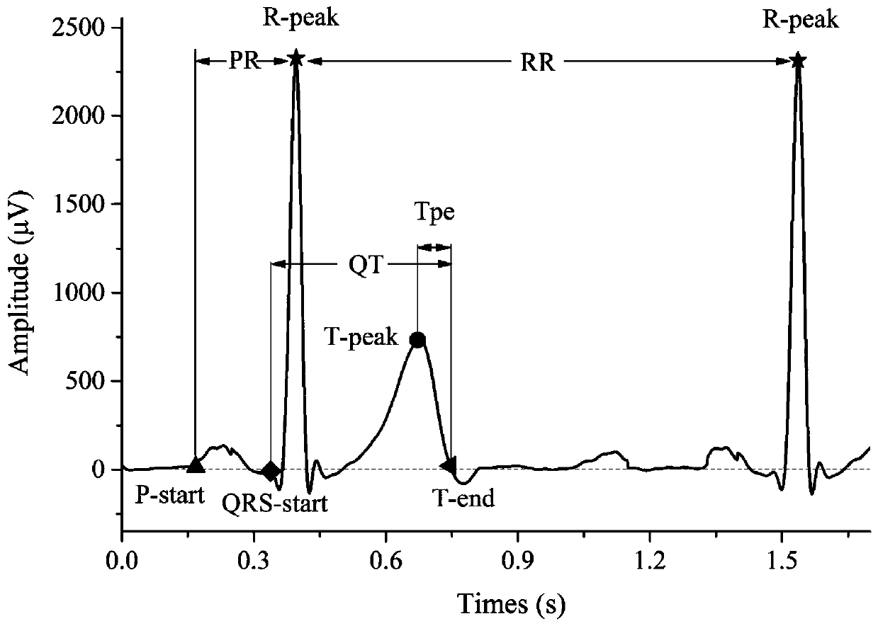 Sleeping state recognition classification method based on electrocardiogram data