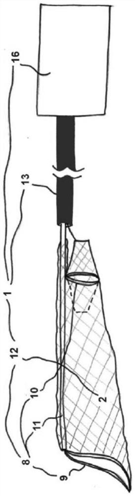 Transcatheter anti embolic filter for arterial and venous vessels