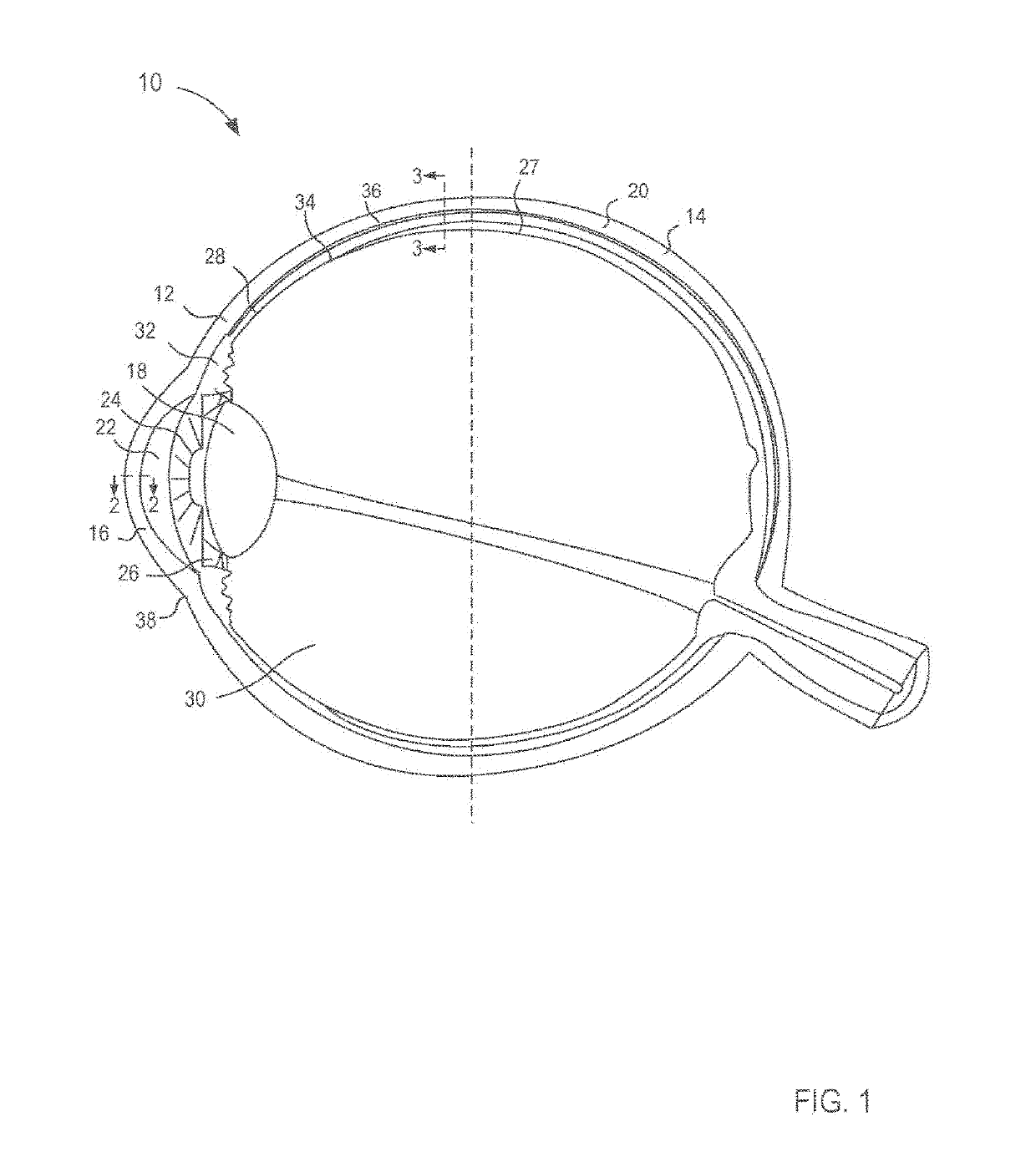 Compositions and methods for treating noninfectious uveitis