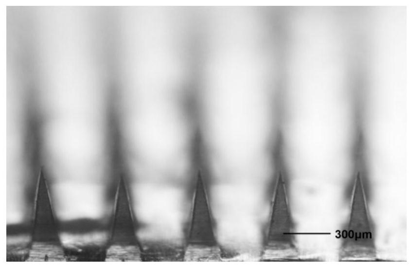 Recombinant hirudin microneedle drug delivery system and preparation method thereof