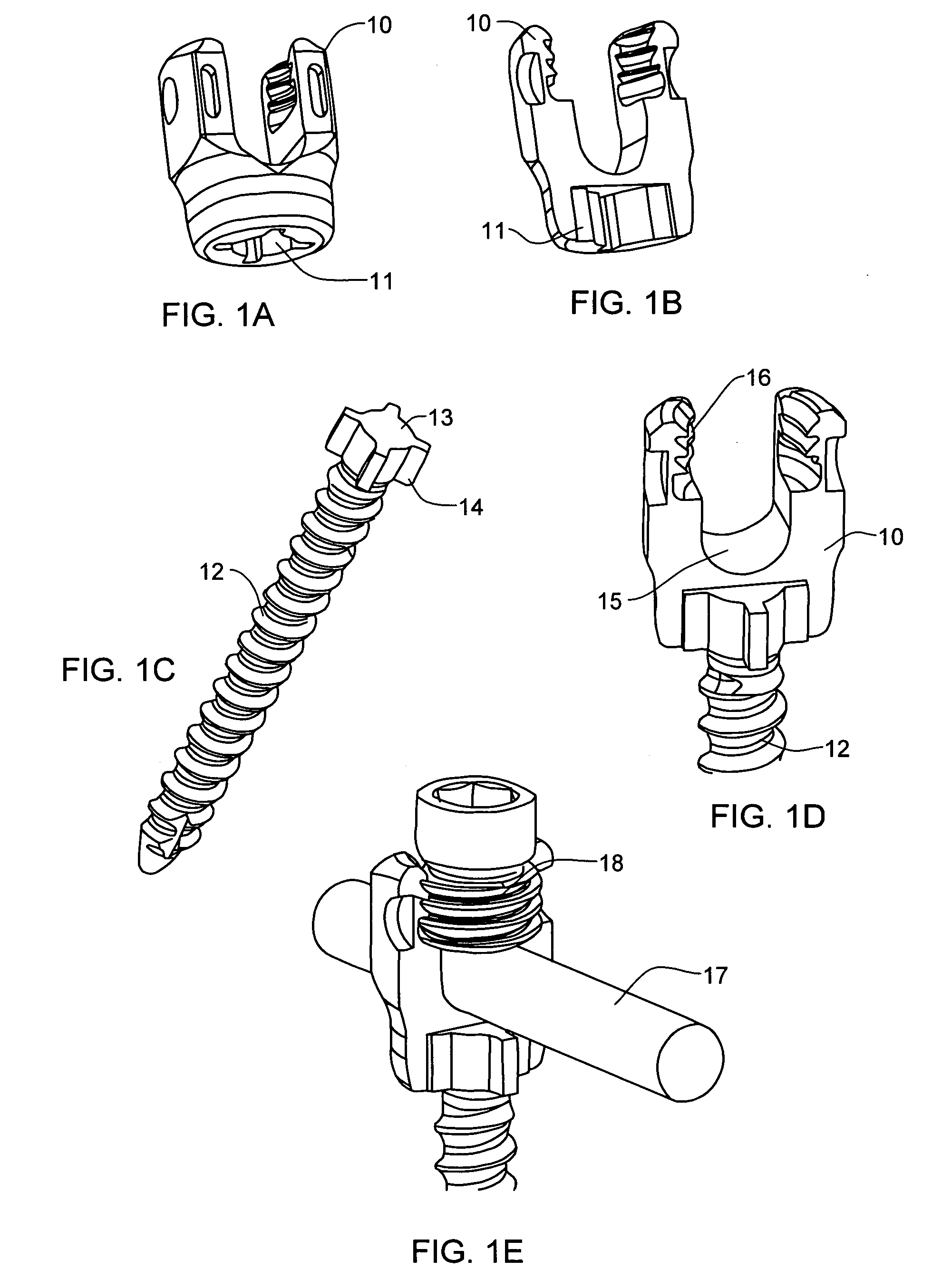 Bone anchor system utilizing a molded coupling member for coupling a bone anchor to a stabilization member and method therefor
