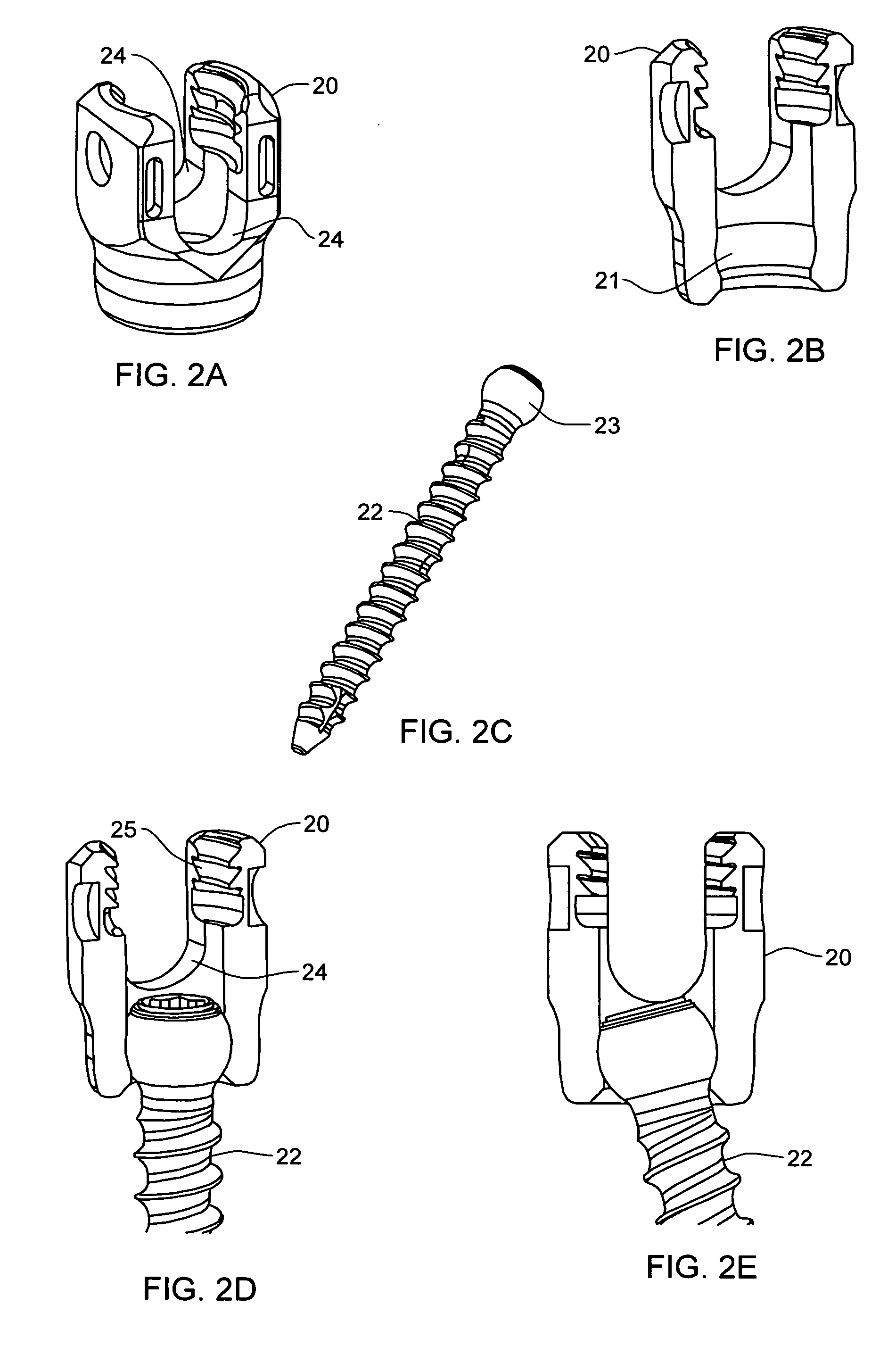 Bone anchor system utilizing a molded coupling member for coupling a bone anchor to a stabilization member and method therefor