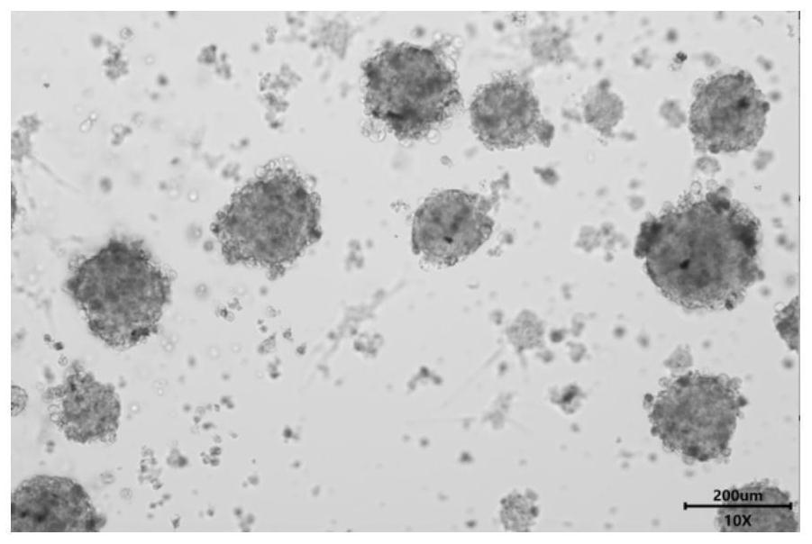 A kind of 3d culture medium of brain glioma organoid and its application