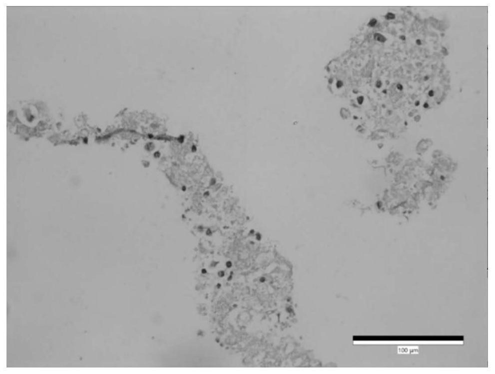 A kind of 3d culture medium of brain glioma organoid and its application