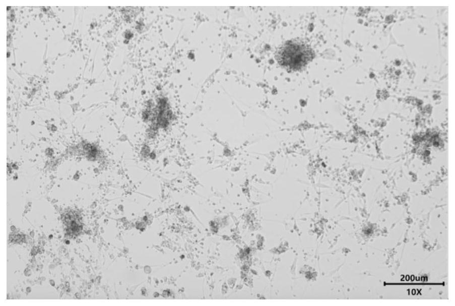 A kind of 3d culture medium of brain glioma organoid and its application