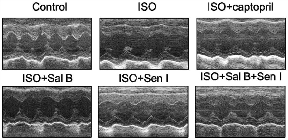 Skyunolide I compound and application thereof in treating myocardial hypertrophy disease