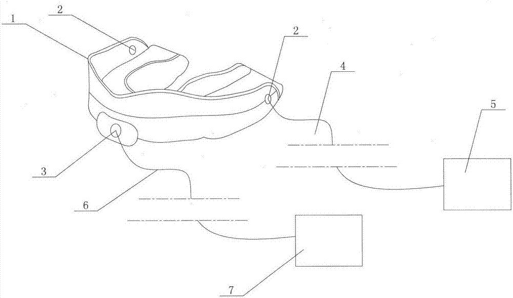 Oral local anesthesia device