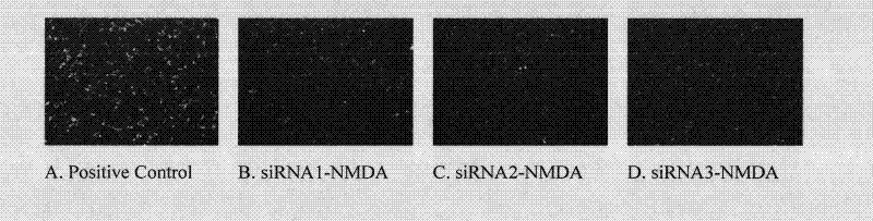 Small RNA for human and rat-homologous NMDA receptor NR2B and application thereof