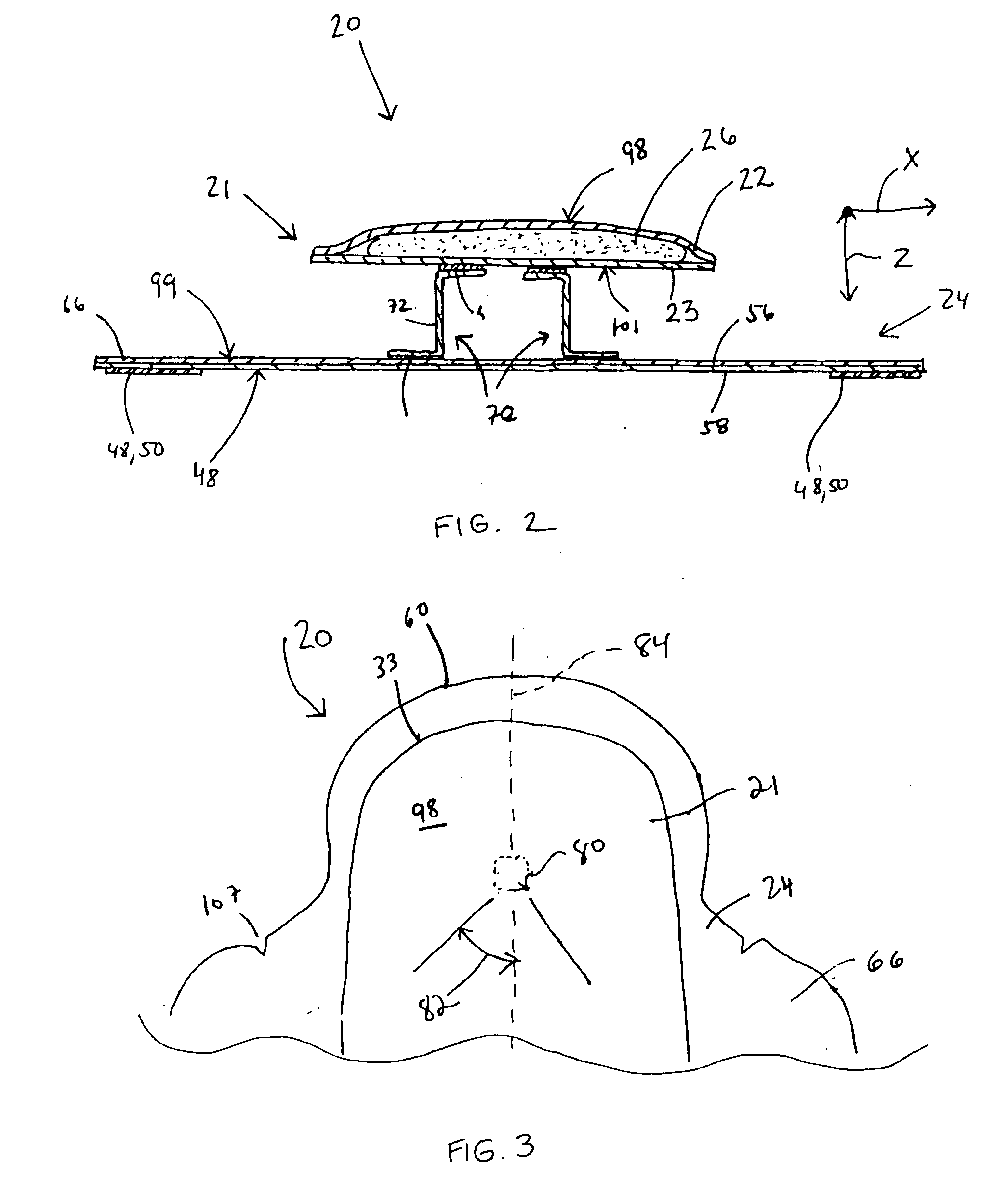 Compound absorbent article with improved body contact