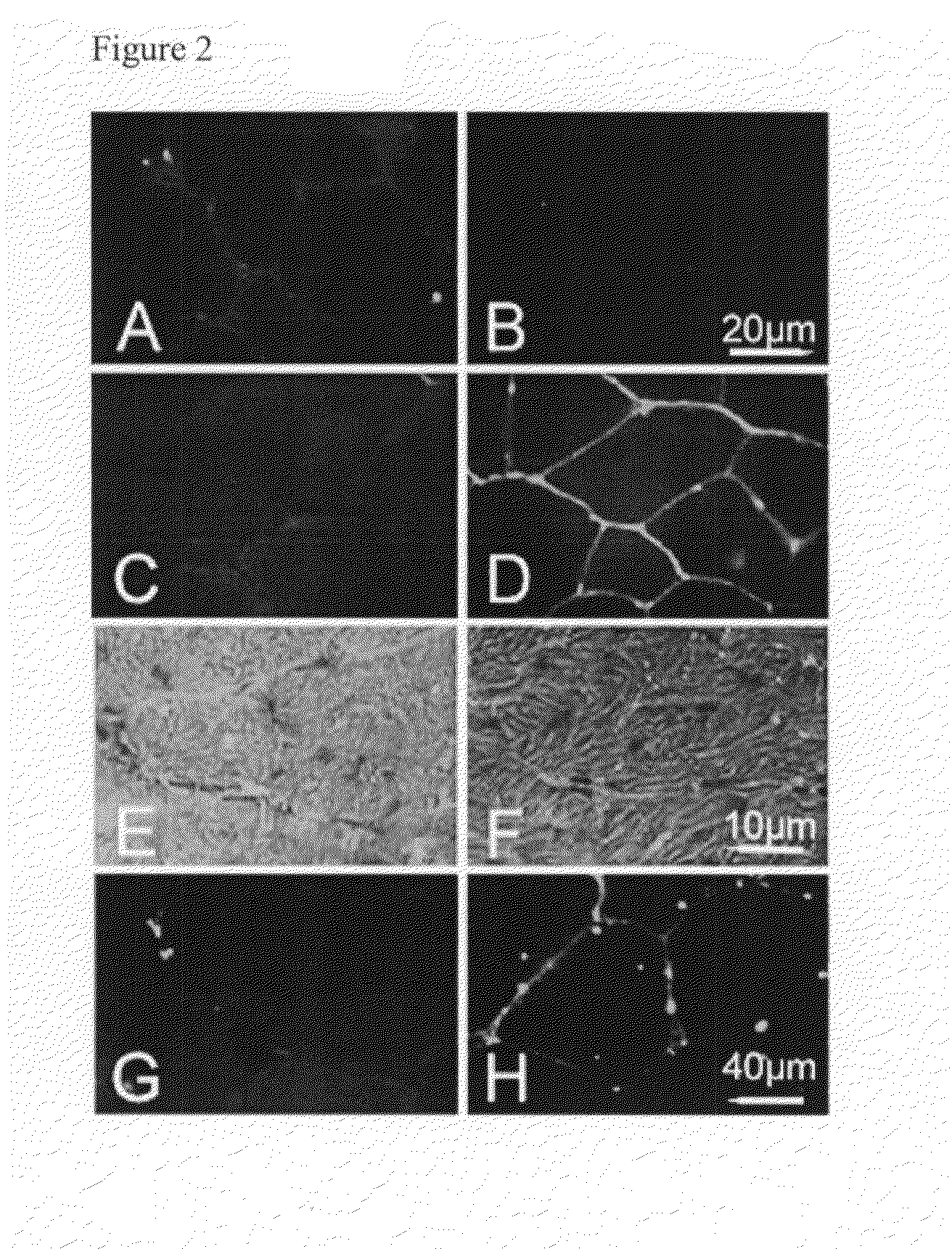 Methods for the treatment of muscular dystrophy associated with dysferlin-deficiency