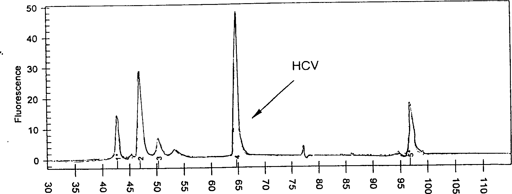 Process for simultaneously carrying out RNA and DNA extraction from clinical samples by employing virus cracking liquid and precipitation process