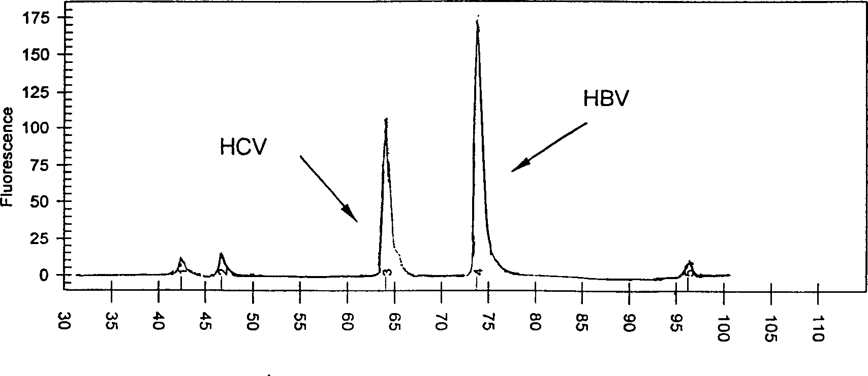 Process for simultaneously carrying out RNA and DNA extraction from clinical samples by employing virus cracking liquid and precipitation process