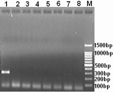 Quick Clavibacter michiganensis subsp. michiganensis IC-PCR detection kit, its preparation method and its application method