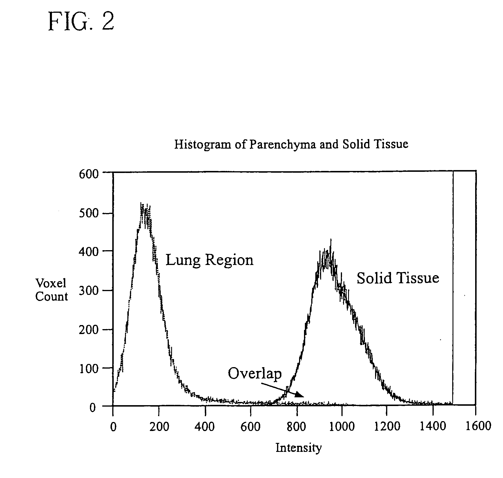 System, method and apparatus for small pulmonary nodule computer aided diagnosis from computed tomography scans