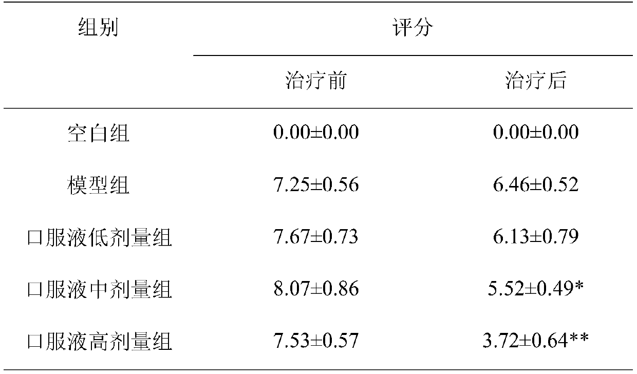 Application of traditional Chinese medicine composition in preparation medicament for treating upper airway cough syndrome