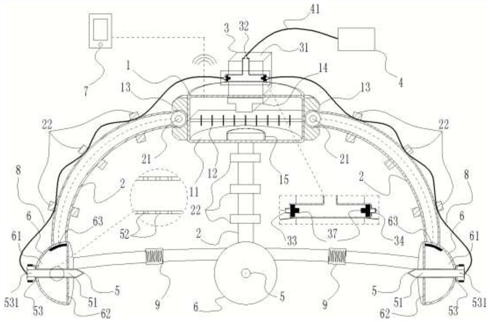 An Intelligently Adjustable Negative Pressure Fastening Corrective Skull Traction Device