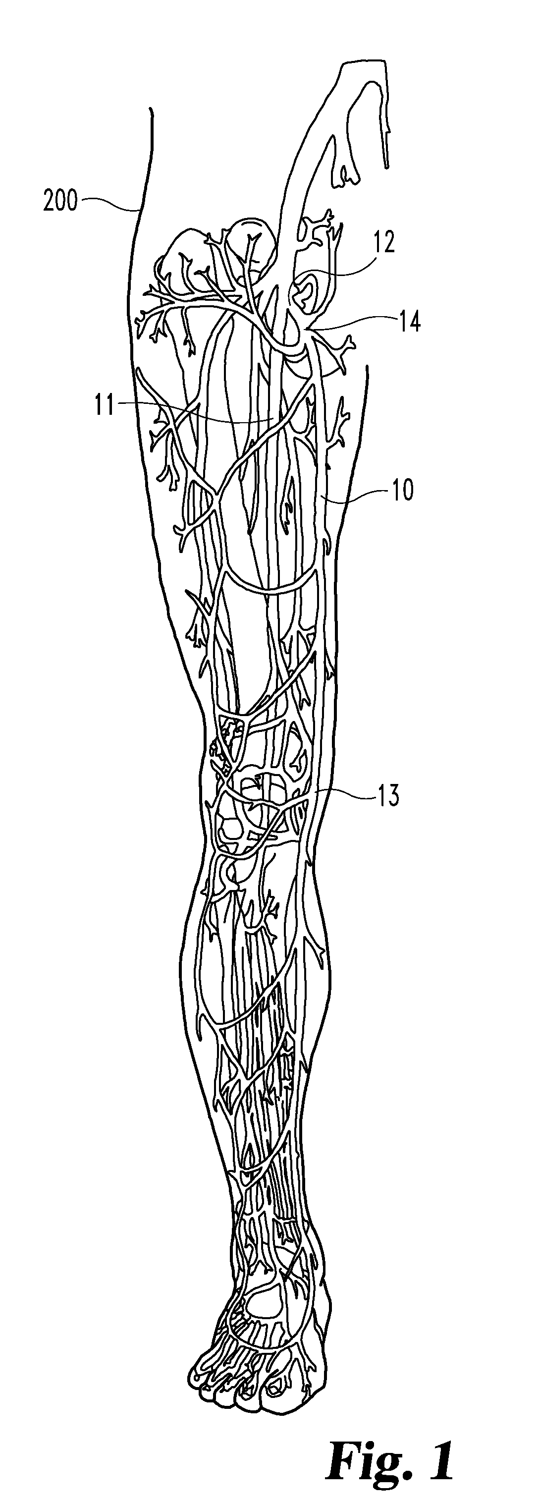 Inverting occlusion devices, methods, and systems