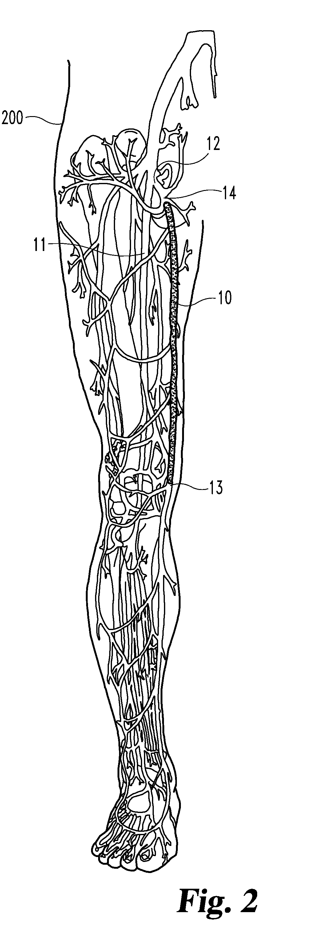 Inverting occlusion devices, methods, and systems