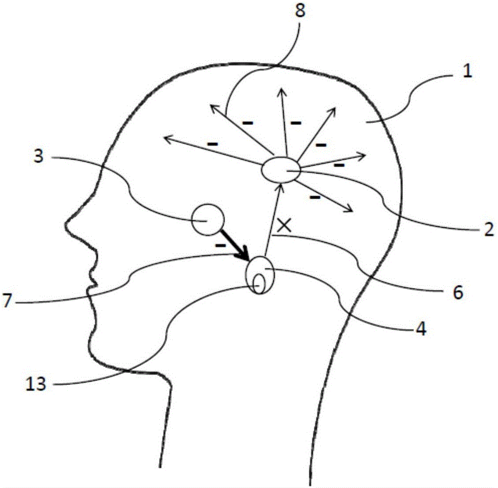 Method and instrument for modulating brain sleep excitation region using electromagnetic field