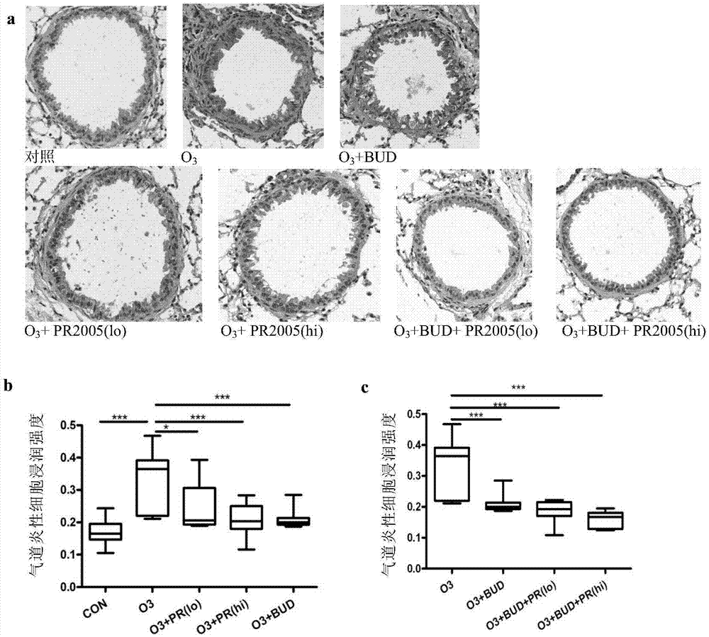 Application of 17-alpha hydroxyprogesterone compound in preventing and treating inflammatory disease of neutrophil