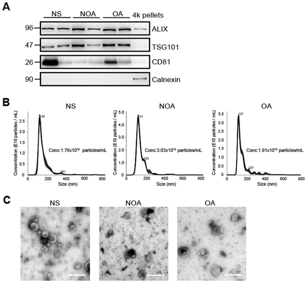 Application of slc5a12 protein in seminal plasma extracellular vesicles
