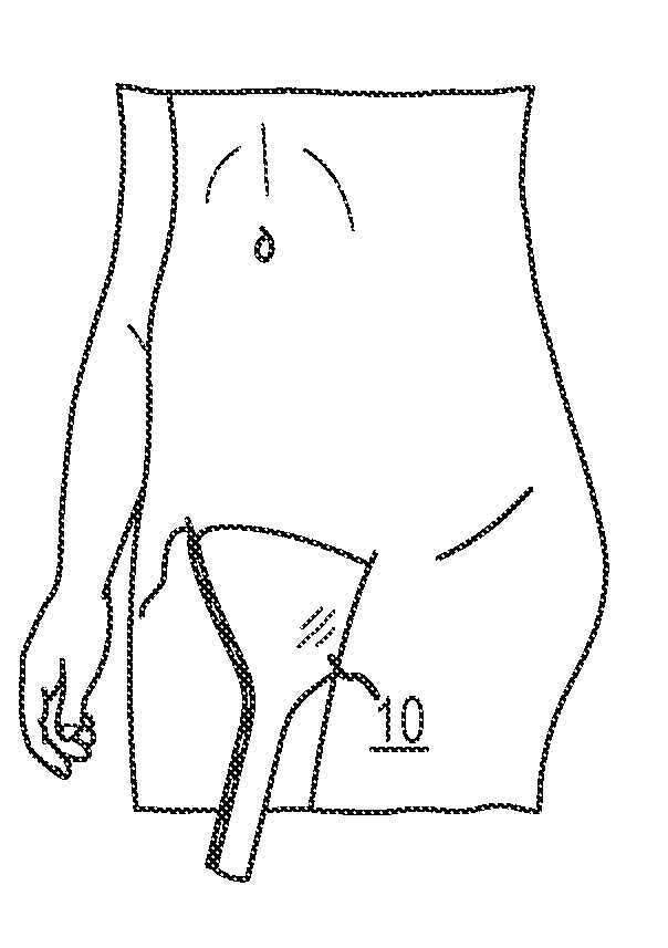 Disposable female urinary aid
