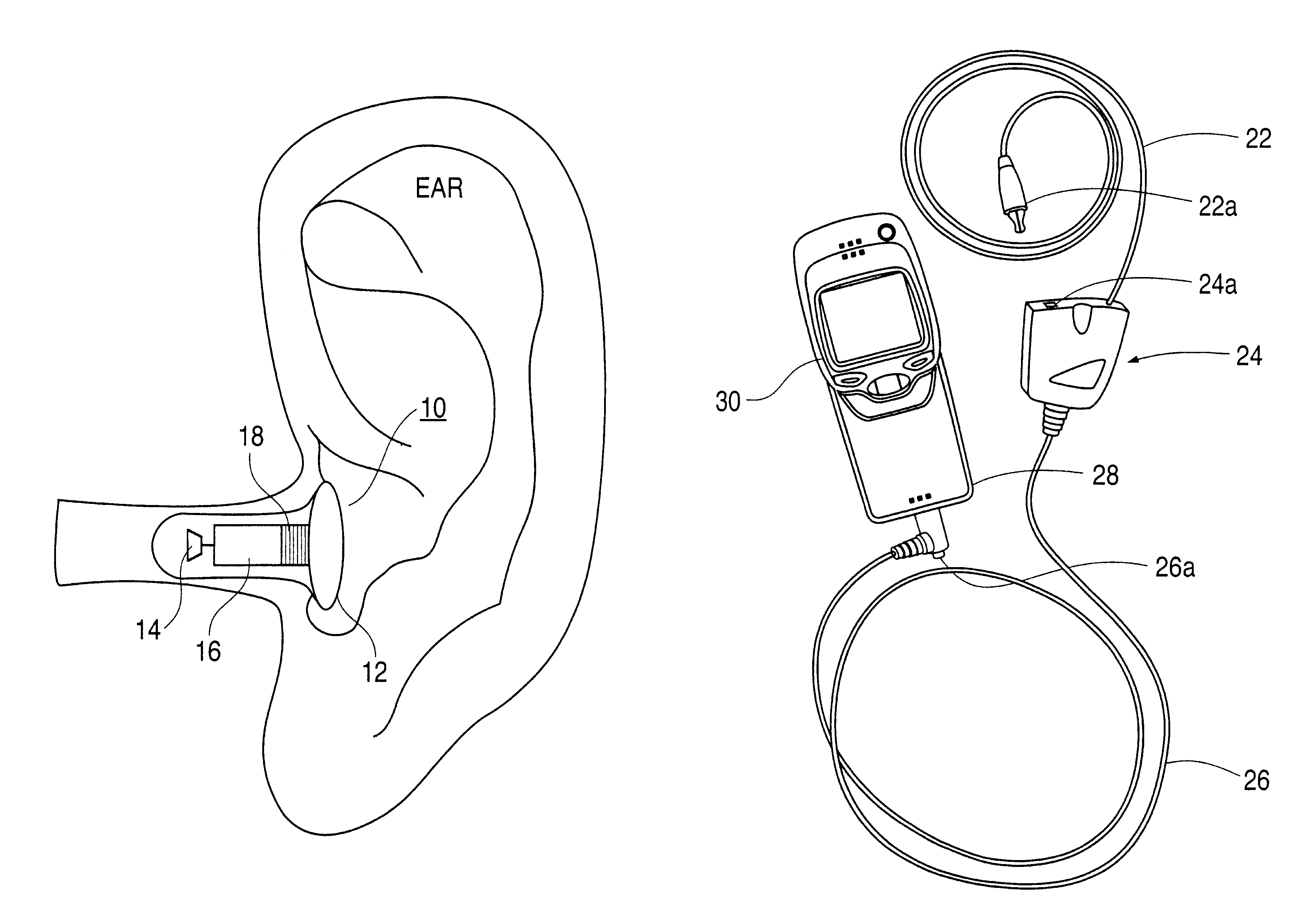 Garment having wireless loopset integrated therein for person with hearing device
