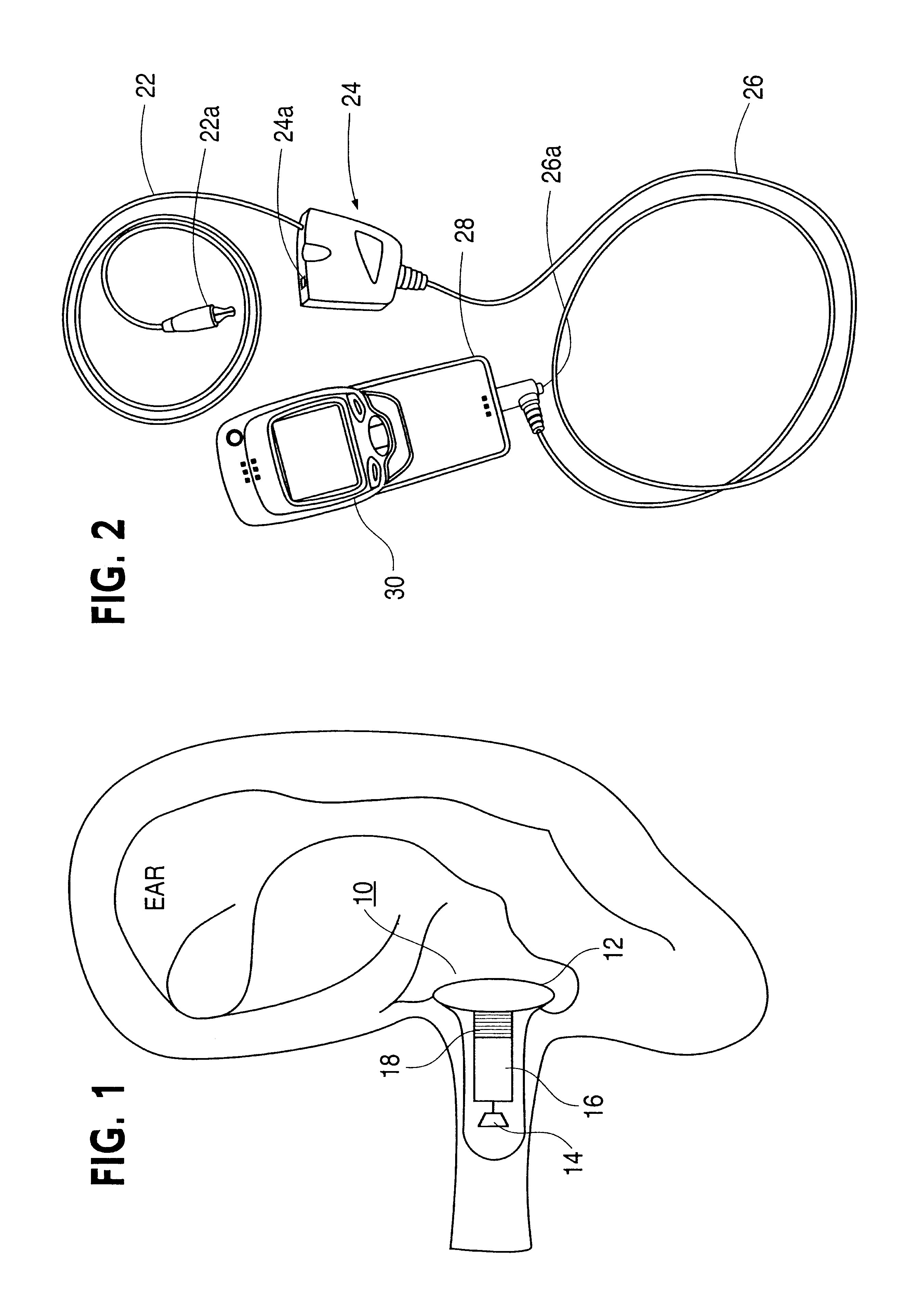 Garment having wireless loopset integrated therein for person with hearing device
