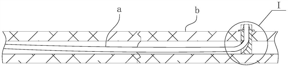 A clavicle intramedullary nail fixation anchor and a clavicle intramedullary nail fixation device