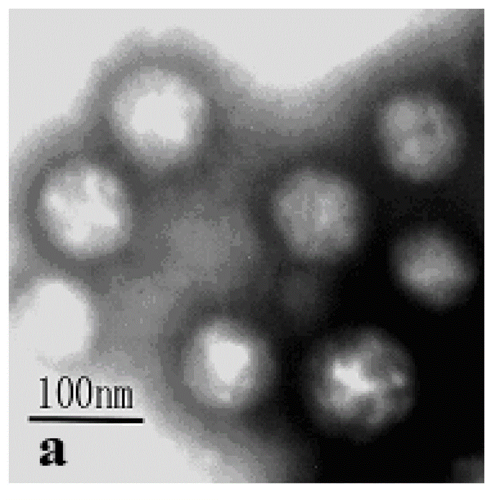 A kind of urease nanoreactor and preparation method thereof