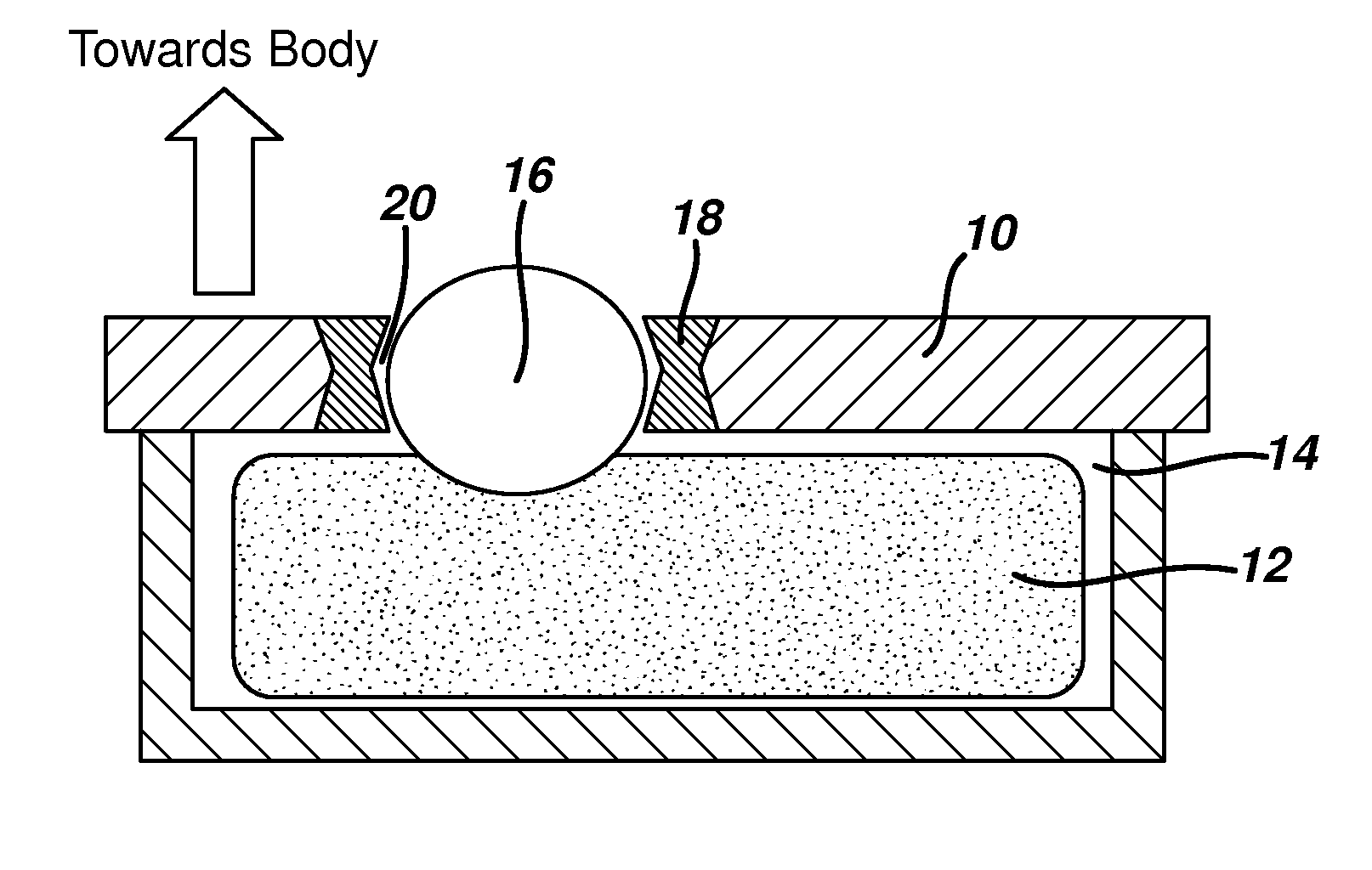 Thermal treatment device