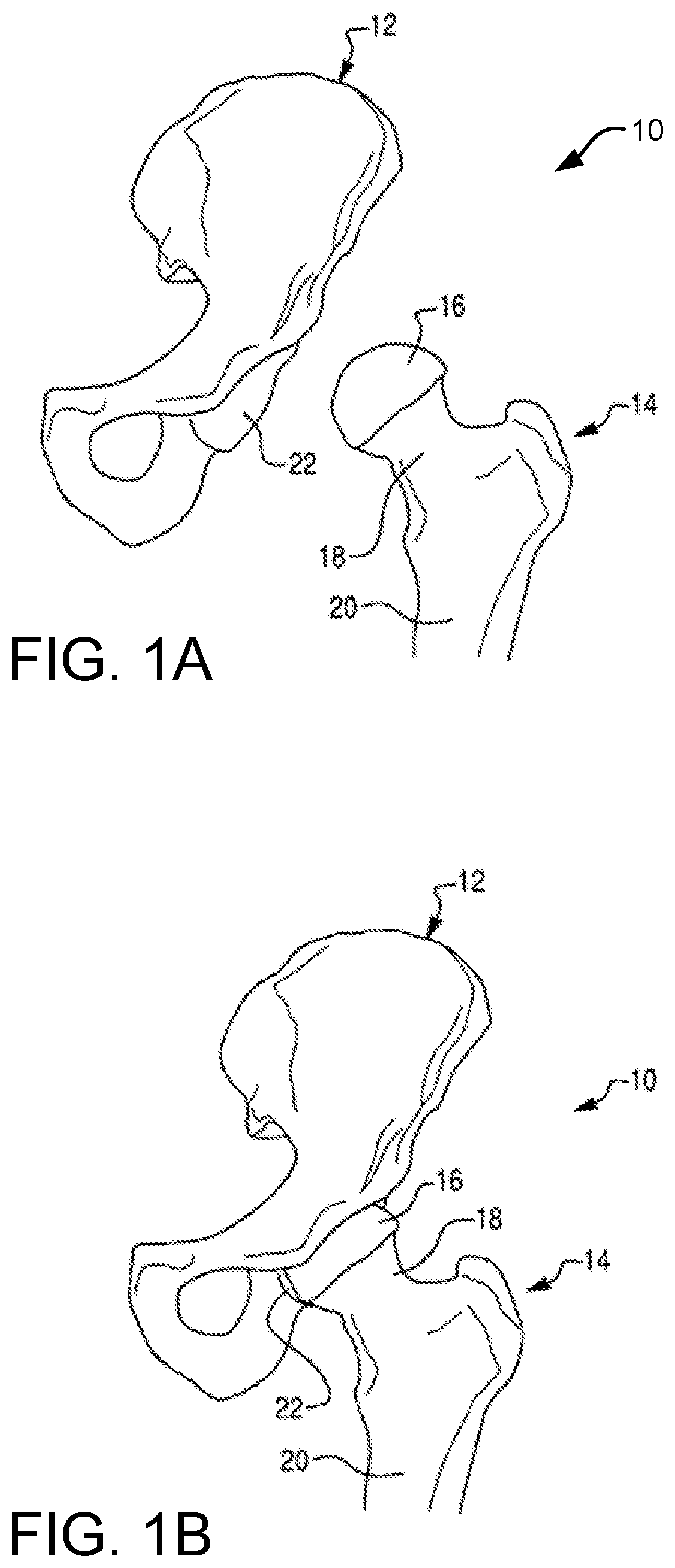 Registration tools, systems, and methods