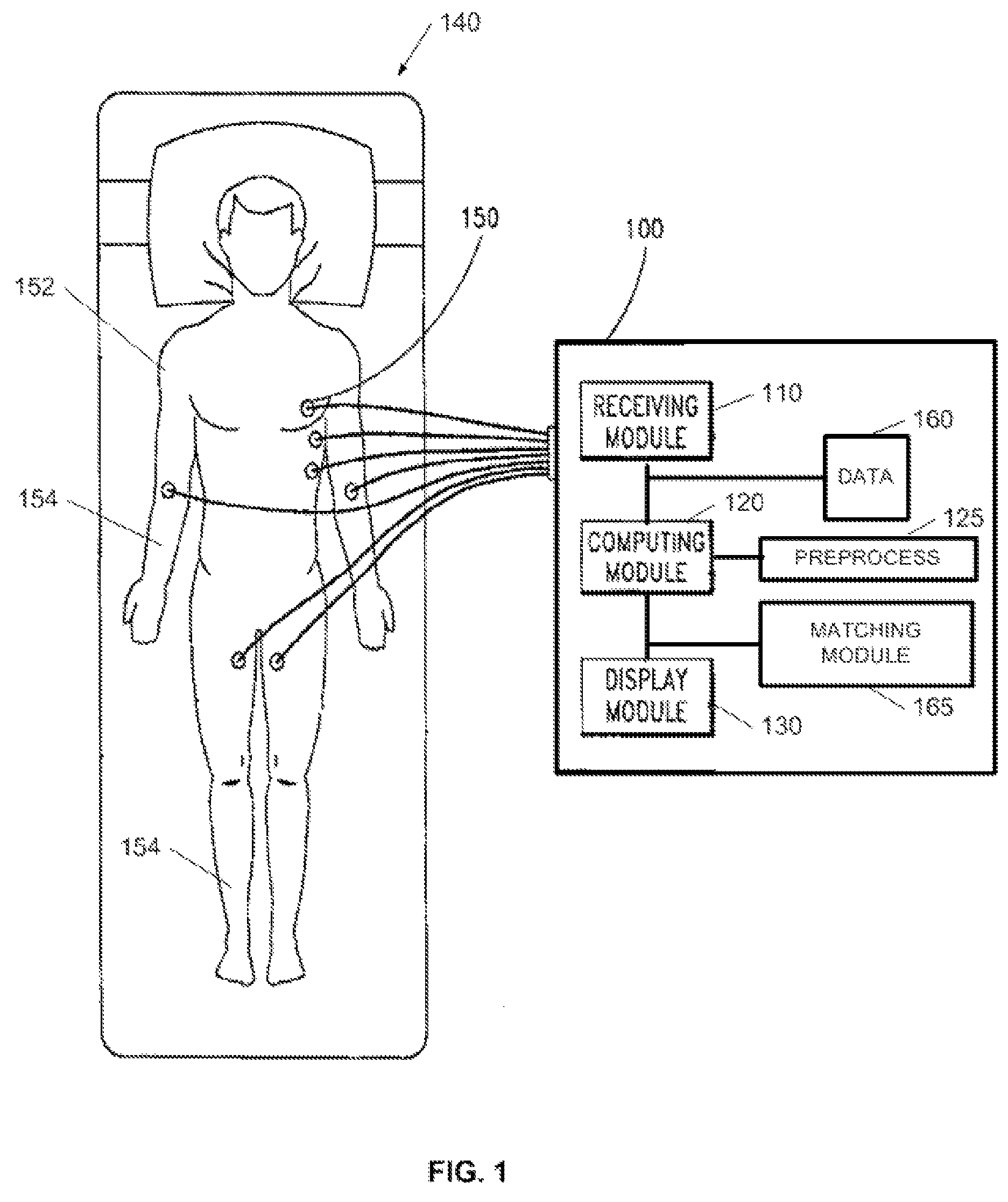 Device and method for detecting cardiac impairments